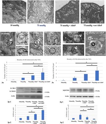 The Enantiomer of Allopregnanolone Prevents Pressure-Mediated Retinal Degeneration Via Autophagy